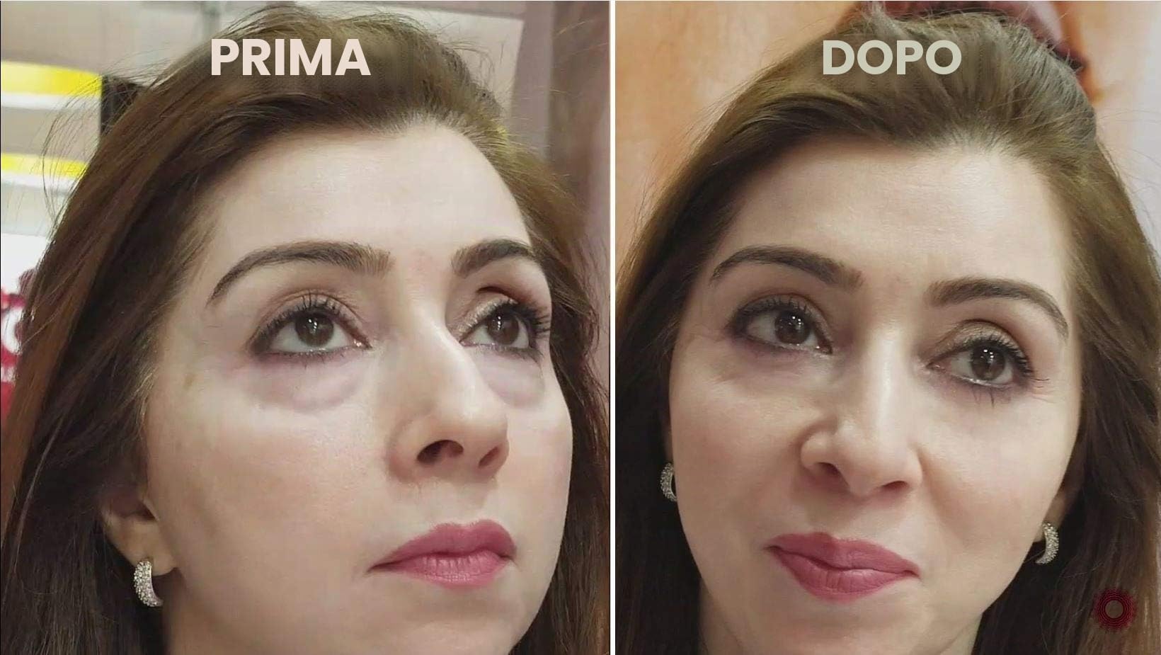 Instant Ageback (crema effetto lifting)