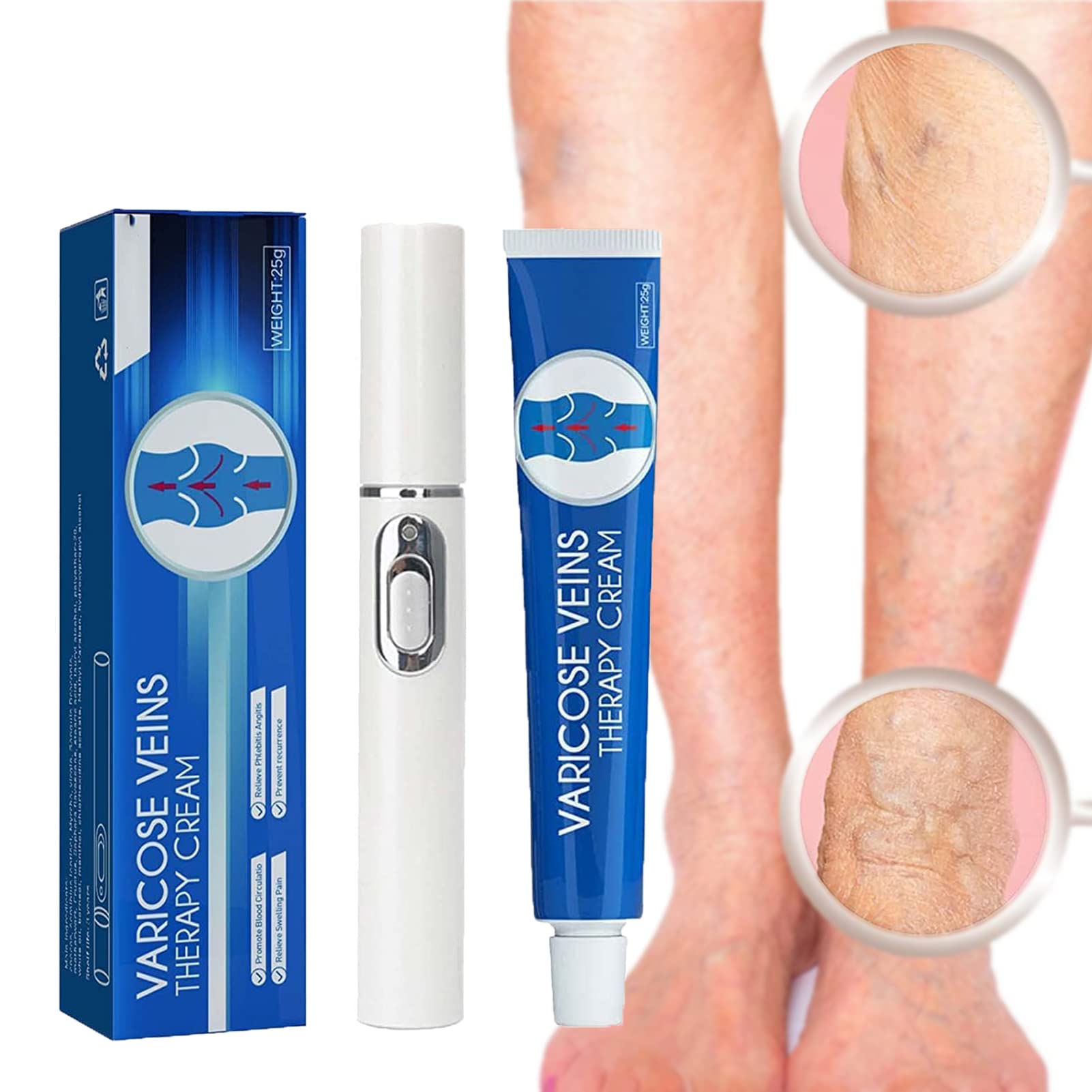 Buy Veins Varicose Veins Blue Light Therapy Set Varicose Veins Cream with Blue Light Therapy