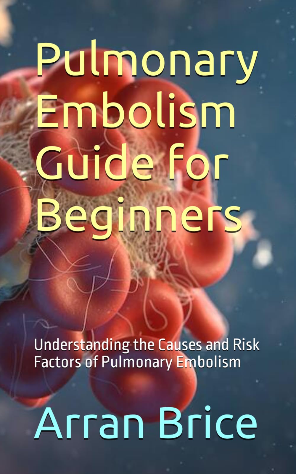 Pulmonary Embolism Guide for Beginners: Understanding the Causes and Risk Factors of Pulmonary Embolism