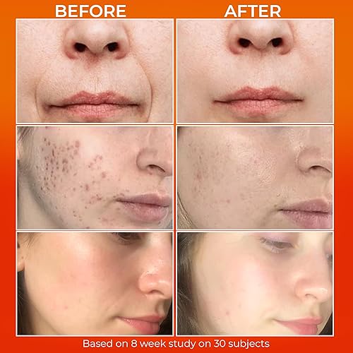 Miniatura 4 de Millionaire Glow  Mucina de caracol  Niacinamida  Suero facial antienvejecimiento para piel opaca, hidratante, reparador, reafirmante  Gotas