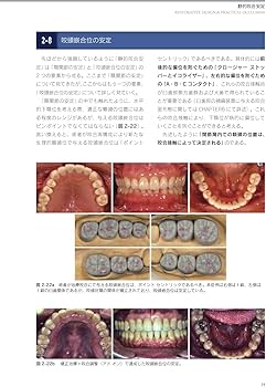 健康・医学 Restorative Design & Practical Occlusion Restorative Design & Practical Occlusion