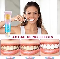 Vista 5 de Pasta de dientes blanqueadora de niacinamida, pasta dental blanqueadora radiante, pastas dentales blancas intensivas de niacinamida, pastas dentales