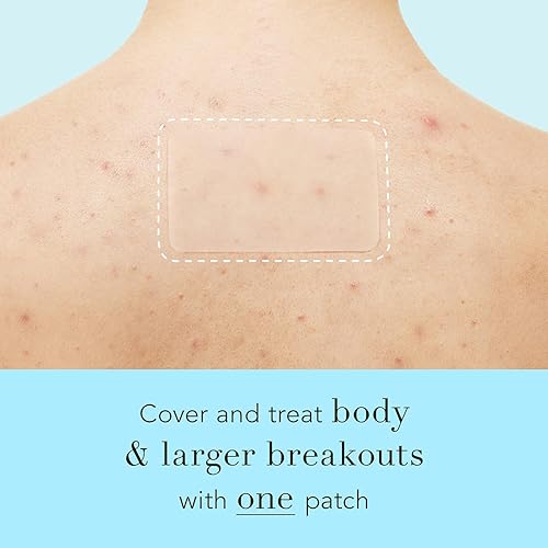 Miniatura 5 de Rael Parches para espinillas, cubierta de control de manchas Miracle XL, parche hidrocoloide para el acné para cara, acné y manchas, espalda y