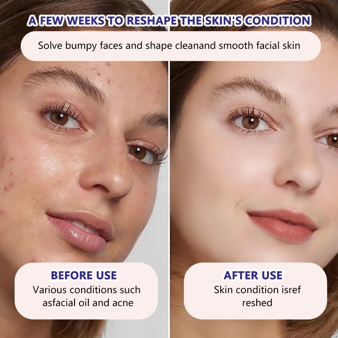 Schiuma Detergente per Pelle Impura：Detersione profonda per rimuovere trucco e impurità. Aiuta a liberare i pori e a purificare la pelle.