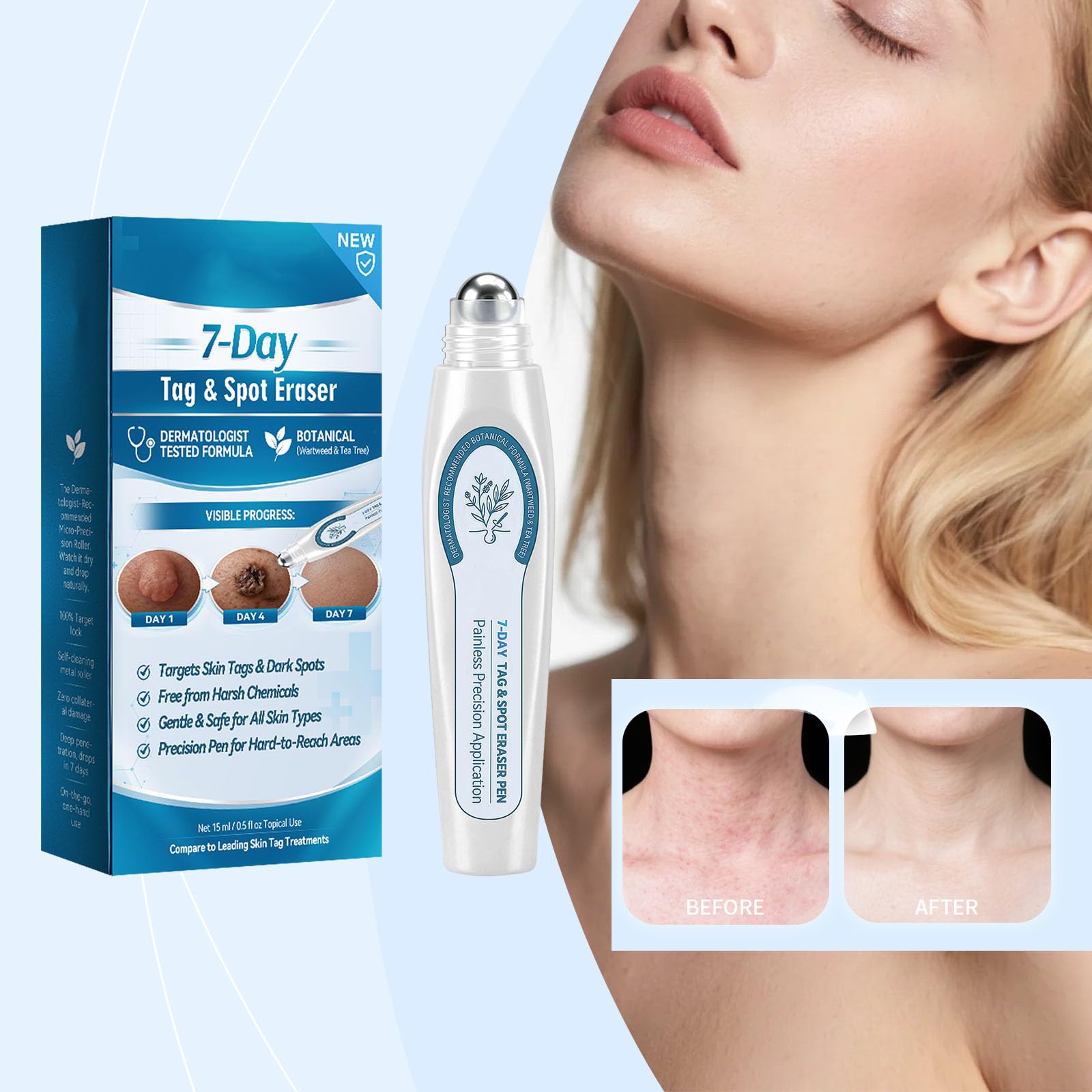 Skin Tag Remover,7 Day Spot and Tag Remover, 7-Tage Hautflecken und Hautanhängsel Entferner, Skin Tag Entferner, Hautfleckenentfernungsstift für Gesicht und Körper ，3PCS