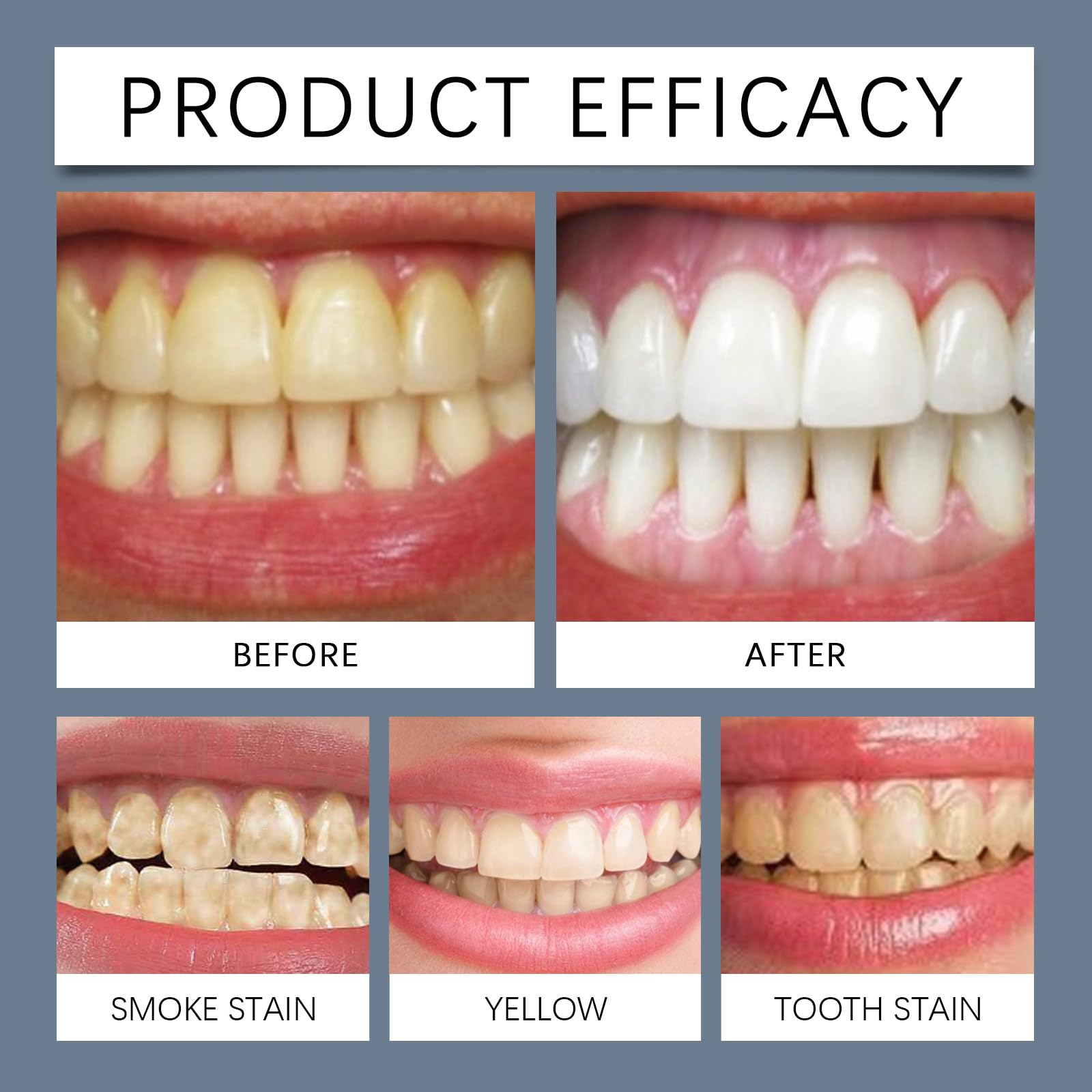 Zealburst, dentifricio, idrossiapatite senza fluoro, dentifricio sbiancante con olio di cocco, xilitolo e antiossidante naturale, per proteggere e rafforzare i denti, rimuove le macchie dei denti (4)