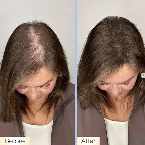 Miniatura 5 de HAIRLOVE Complejo de crecimiento del cabello  Suplemento de queratina para cabello más grueso y fuerte  Ayuda a reducir el desprendimiento, aumentar