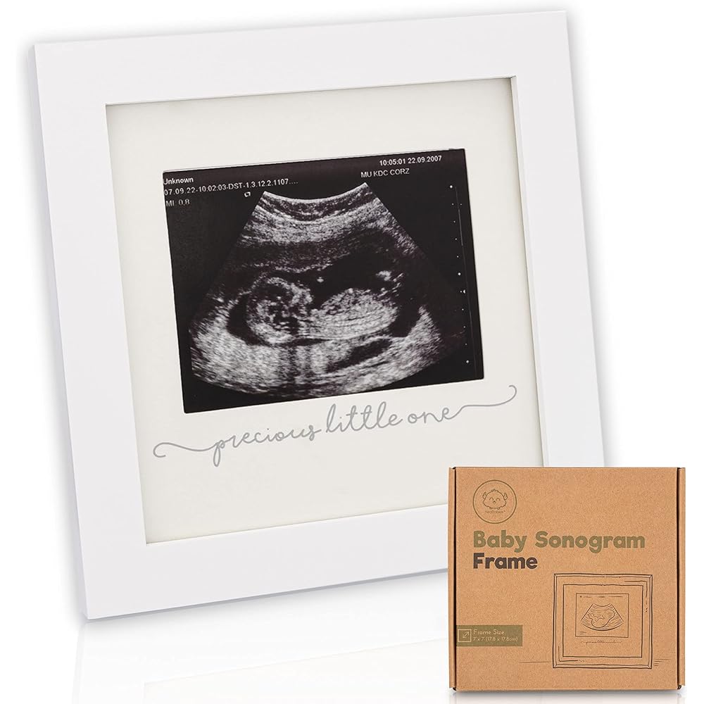 2/mo Finance Baby Sonogram Picture Frame Modern Ultrasound Frame