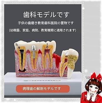 歯科医療模型 口腔外科実習用顎模型 [P15FE-OOP.1](FE咬合器つき)｜株式会社