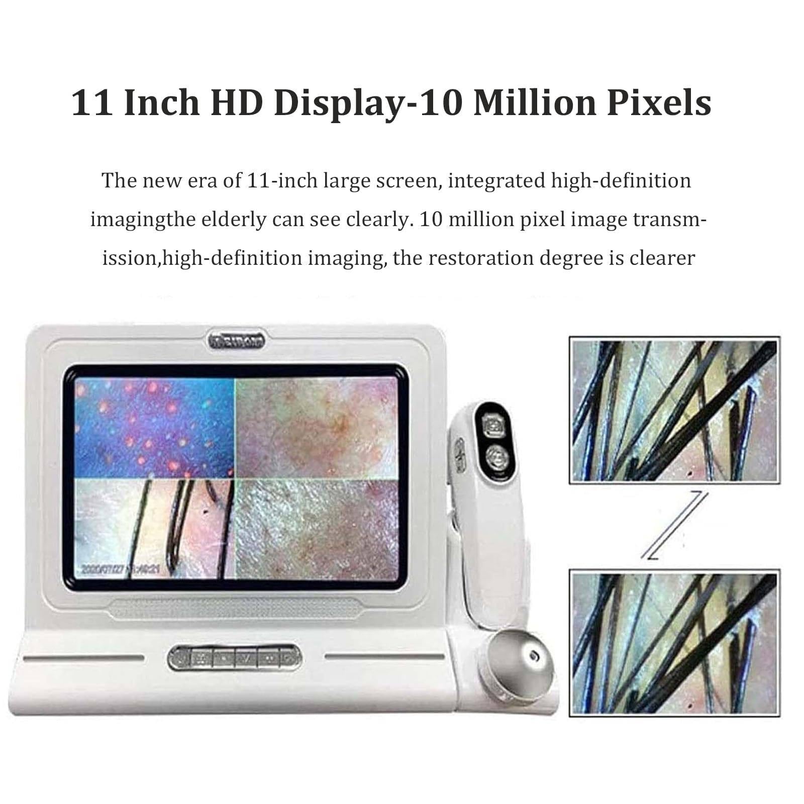 11-Zoll-Haut- Und Haaranalysegerät Mit | 50-Facher/200-Facher Vergrößerung (2 Aufsätze), 16 Gb Speicher & 10 Megapixel – Haarfollikel-Analysegerät