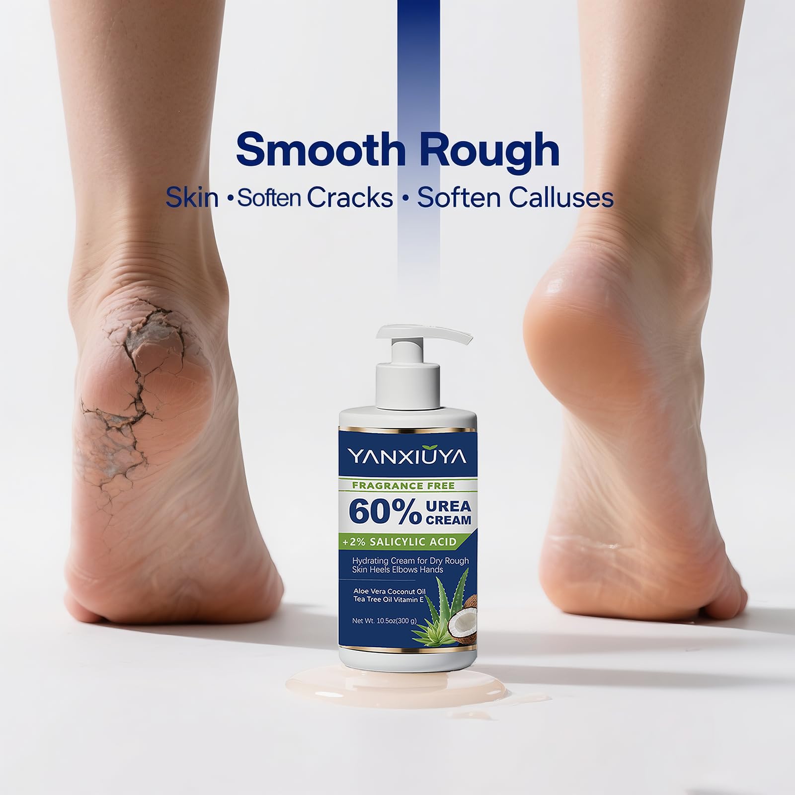 60% Urea Cream 10.5 oz, Fragrance-Free Body Lotion with 2% Salicylic Acid, Foot Cream and for Feet, Cracked Heels, Dry Skin & Callus Remover, Maximum Strength Moisturizing Cream