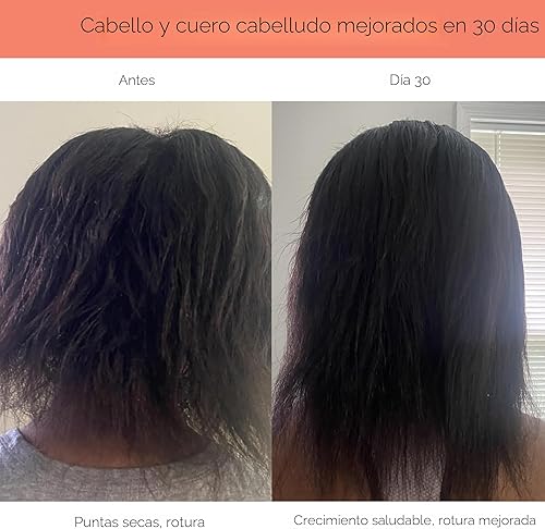 Miniatura 8 de Canopy Cabezal de ducha filtrado, de alta presión para agua dura, para eliminar impurezas para cuero cabelludo, piel y cabello más saludables,