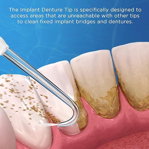 Miniatura 3 de Puntas de repuesto para el hilo dental Waterpik (6 puntas de dentadura de implante y paquete de estuche de almacenamiento)