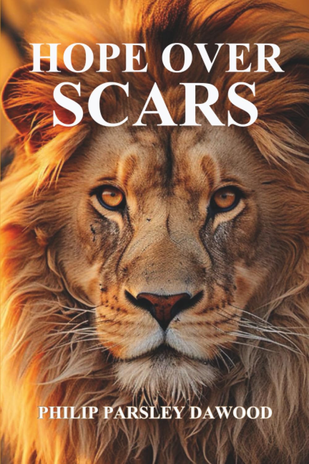 HOPE OVER SCARS: How God Turns Pain Into Purpose And Scars Into Testimonies