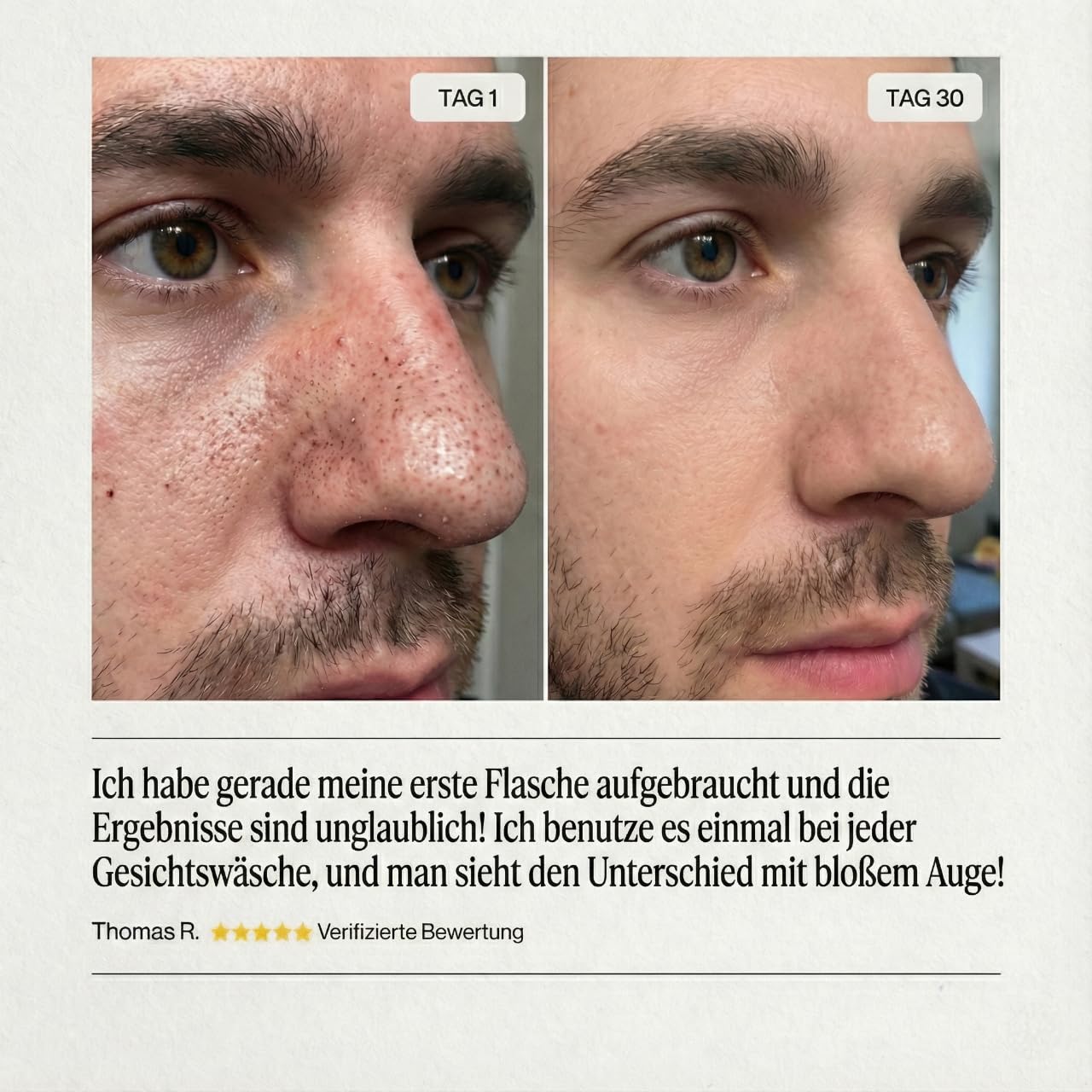 Peel Shot - Vulkan & Weisser Ton - Sanfte Porenreinigung & Tiefenpflege mit Centella & Hyaluron - Gegen Mitesser - 100ml (1x Vulkanerde + 1x Französische Tonerde, 1+1 Duo Basis Lab)