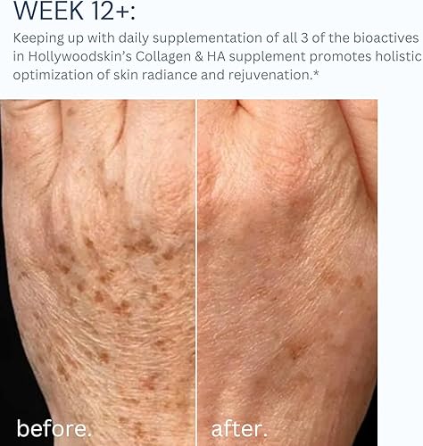 Miniatura 5 de Complejo de colágeno Peptan para un apoyo definitivo que desafía la edad. 1000 mg de colágeno tipo 1 y 3, 300 mg de HA, 100 mg de vitamina C. 1500