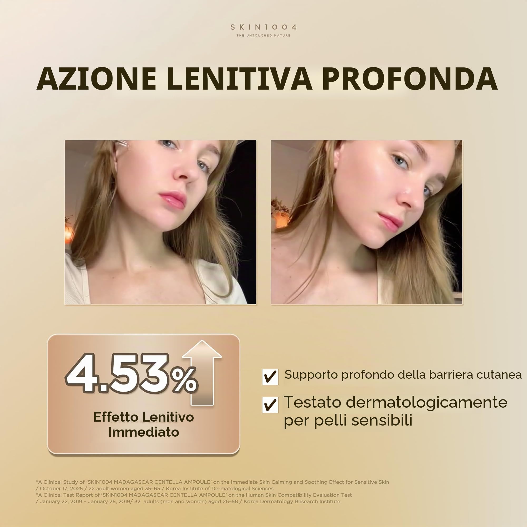 Skin1004, Centella Asiatica del Madagascar, 100 fiale (ml)/ siero viso/estratto 100% di centella asiatica/lenitivo, per pelli sensibili e a tendenza acneica
