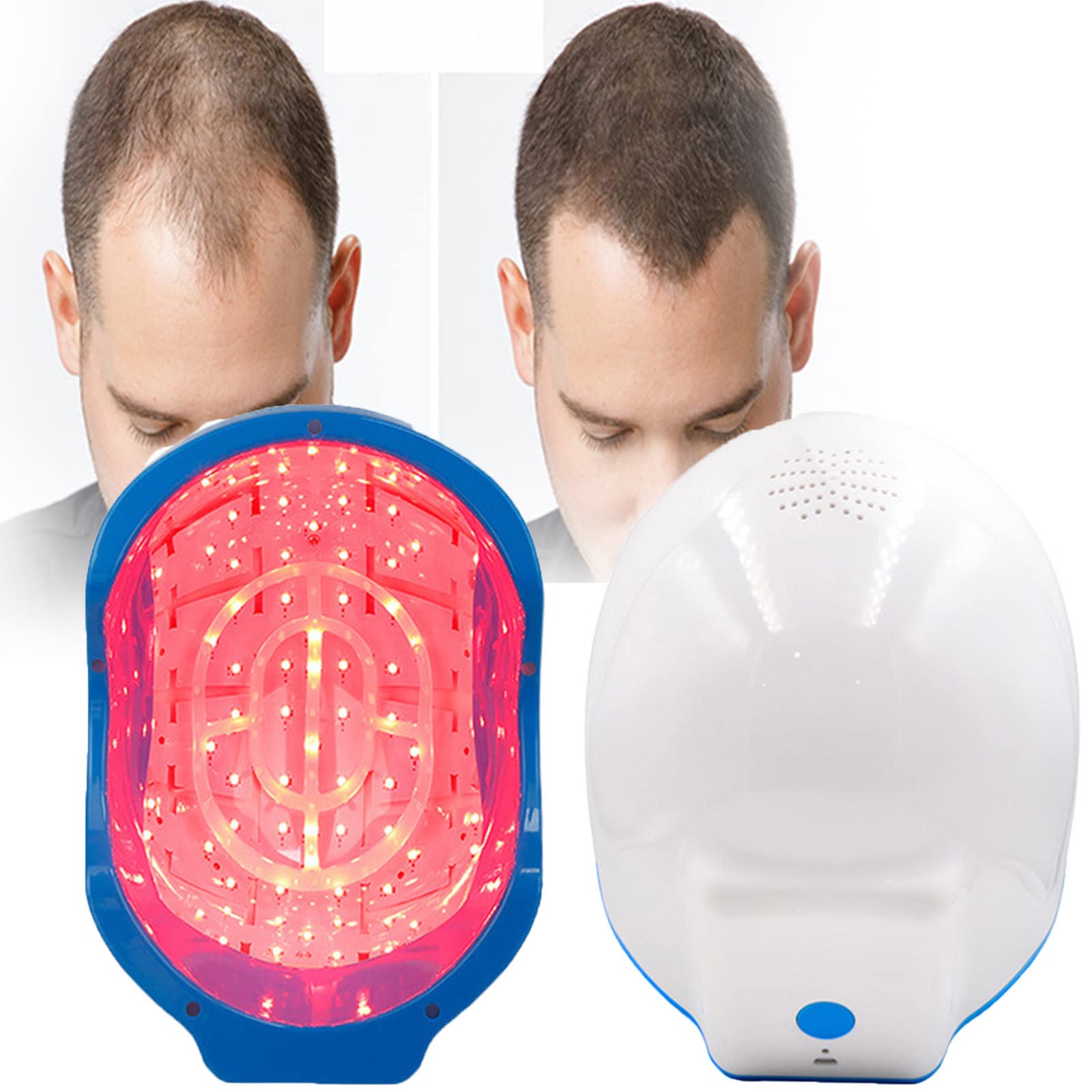 Casque laser anti-chute de cheveux repousse capillaire alopécie et traitement cuir chevelu