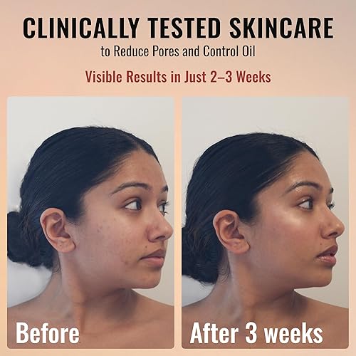 Miniatura 3 de ADM - Suero de retinol puro antienvejecimiento para la cara con niacinamida, rejuvenecimiento, suaviza líneas finas, arrugas, cicatrices de acné,