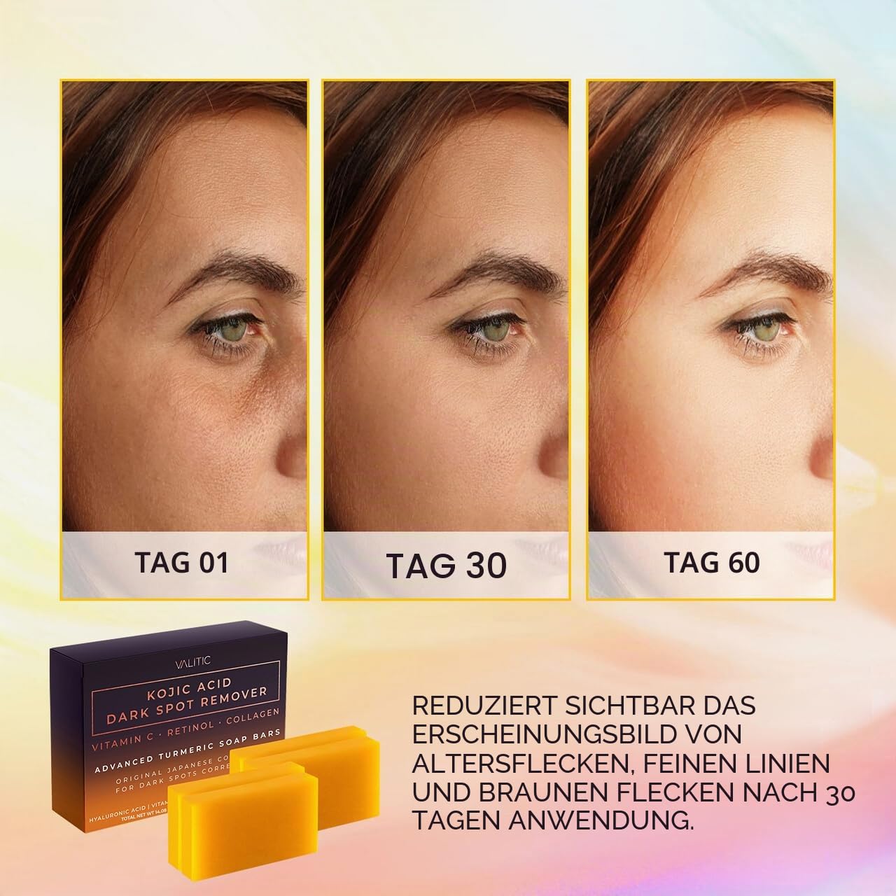 VALITIC - Valitic Kojic Acid Dark Spot Remover Seife mit Vitamin C, Retinol, Kollagen und Kurkuma - Original