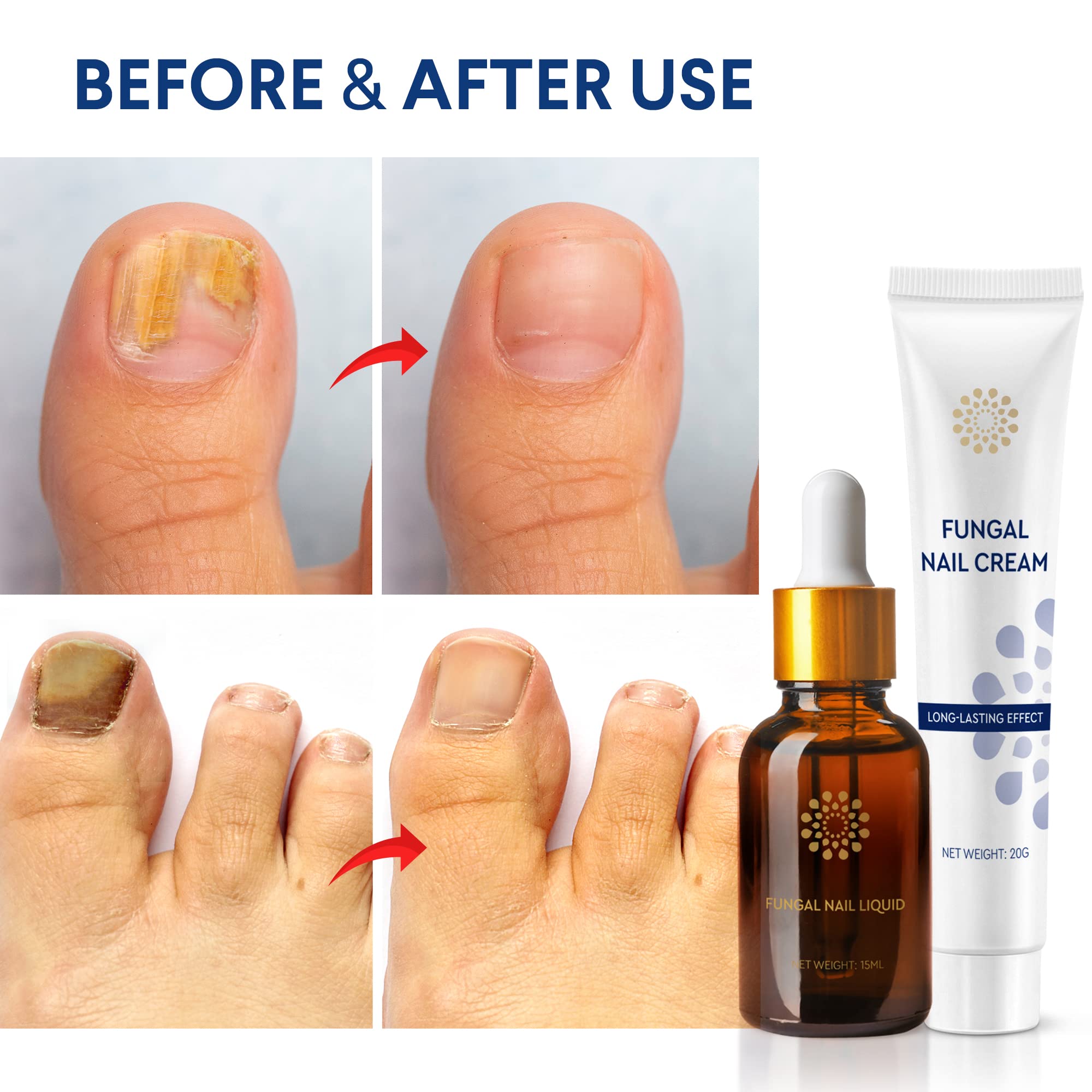 Buy Natural Heals Nail Fungus Treatment for Toenail, Toenail Fungus