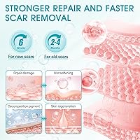Vista 5 de Gel de silicona para cicatrices, ayuda a mejorar el tamaño, el color y la textura de las cicatrices hipertróficas y queloides de lesiones