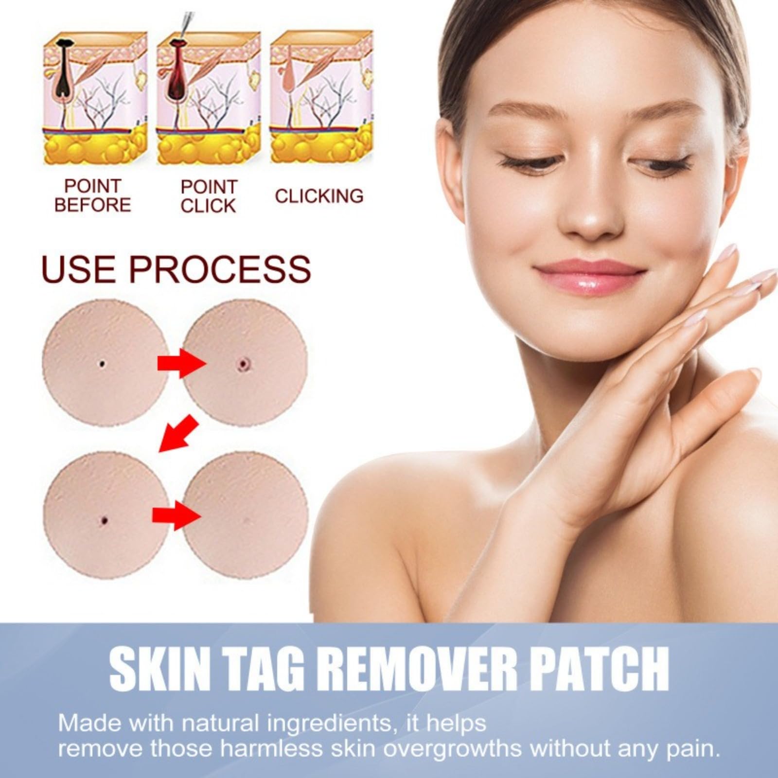 Microneedle & Hydrokoloid, Pimple Patch, długopis do pielęgnacji twarzy, | Usuwacz do plam i skórnych narośli, naturalne składniki, dla kobiet i mężczyzn Haczyki do haczyków, łatwe w użyciu,