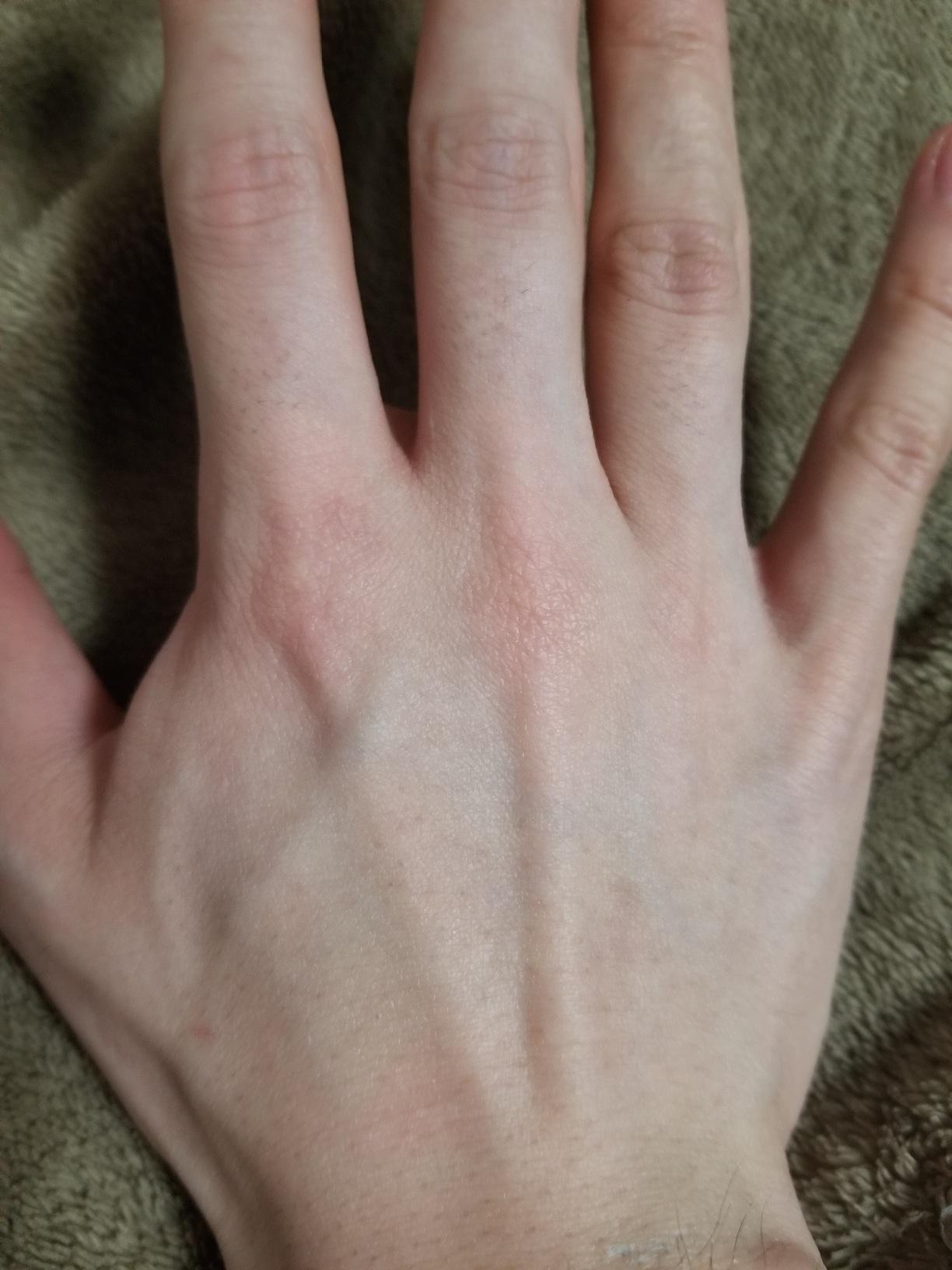 カスタマー画像 Rise Amazonで購入 画像閲覧注意 適当にやると大惨事 説明書をしっかり読んでやりましょう 代男です 体毛で悩む男達の為になればと思いレビューします 本レビューには一部の方に不快な思いをさせる表現があるかもしれません