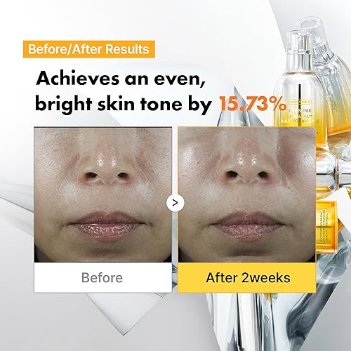 Miniatura 4 de APOTHE Exosome Mela-Glu Dark Spot Ampolla - Suero iluminador con exosomas de uva, niacinamida y arbutina, 1 fl oz (1.0 fl oz)