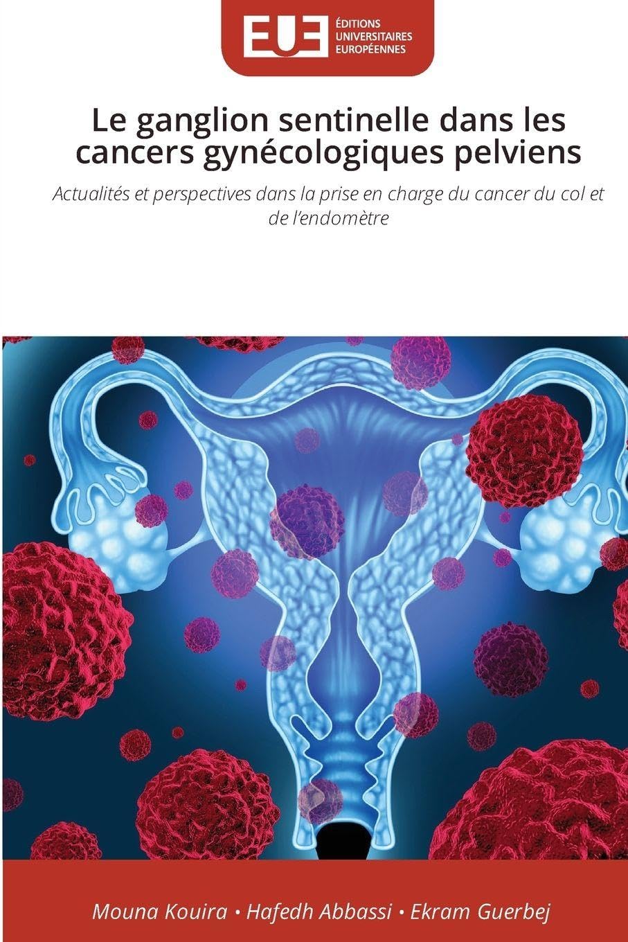 Le ganglion sentinelle dans les cancers gynécologiques pelviens: Actualités et perspectives dans la prise en charge du cancer du col et de l'endomètre