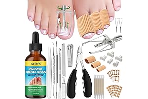 Ingrown Toenail Corrector Kit: Ultimate Relief for Painful Toenails
