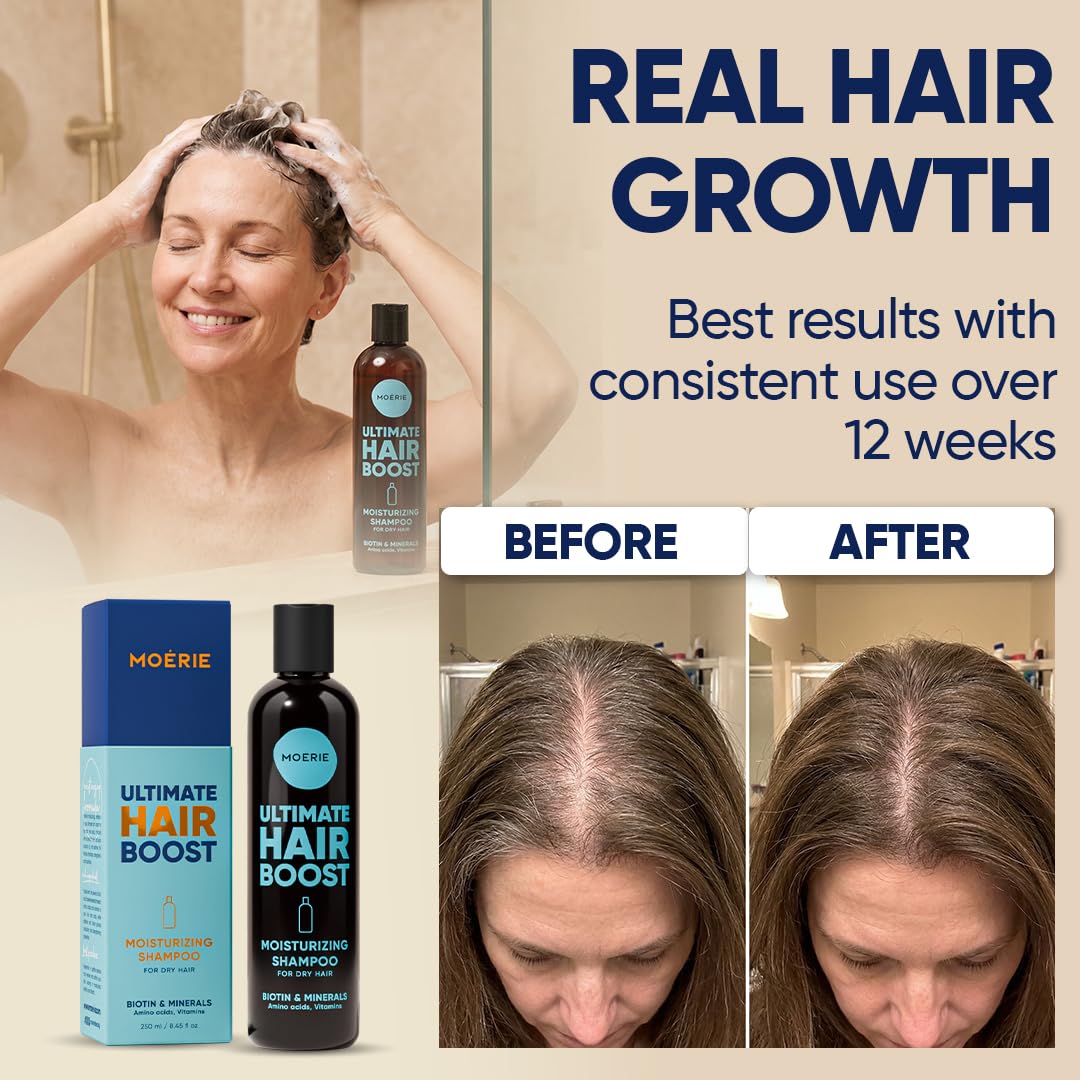 Moerie Ultimate Hair Growth Shampoo - Per capelli più lunghi, spessi e pieni - Prodotti volumizzanti vegani - Senza parabeni e silicone - Tutti i tipi di capelli - Idratante