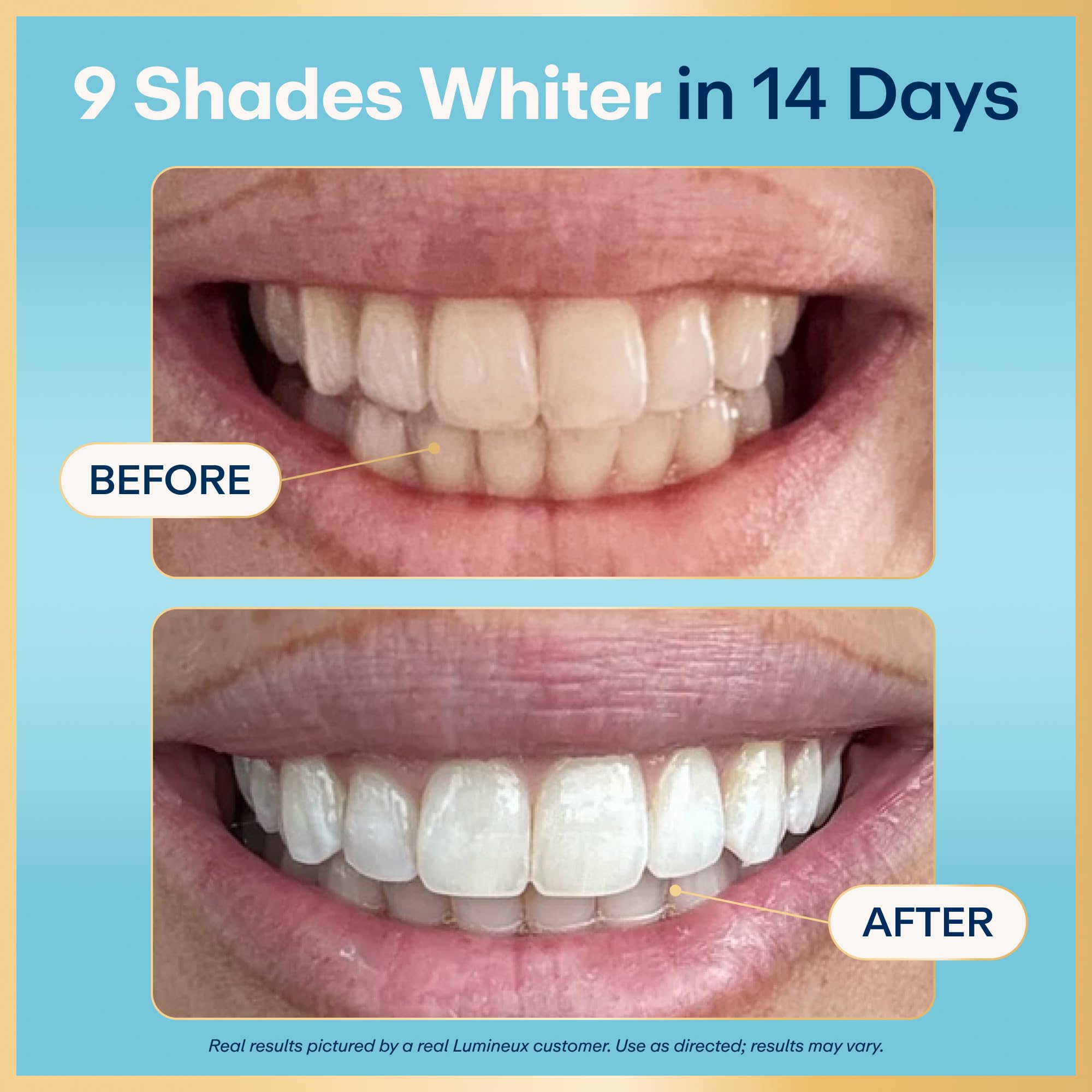 Lumineux Teeth Whitening Strips - 21 Treatments (3 Months) - Peroxide Free - Enamel Safe for Whiter Teeth - Whitening Without The Sensitivity - Dentist Formulated - Sensitivity - 2