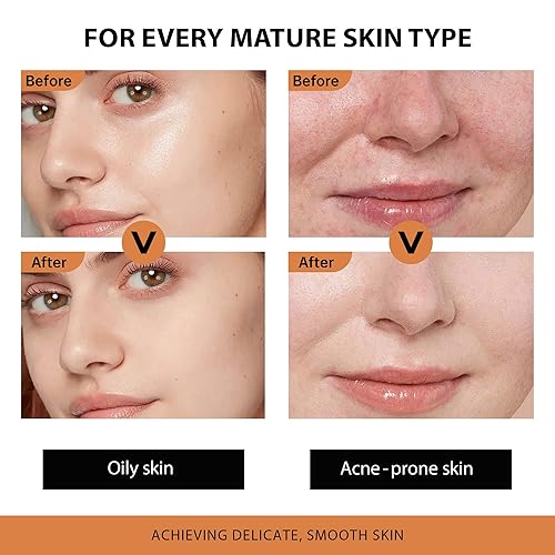 Miniatura 2 de VGO Suero de retinol para la cara  Potencial antienvejecimiento e hidratación para un brillo más firme y juvenil  Ideal para pieles propensas al