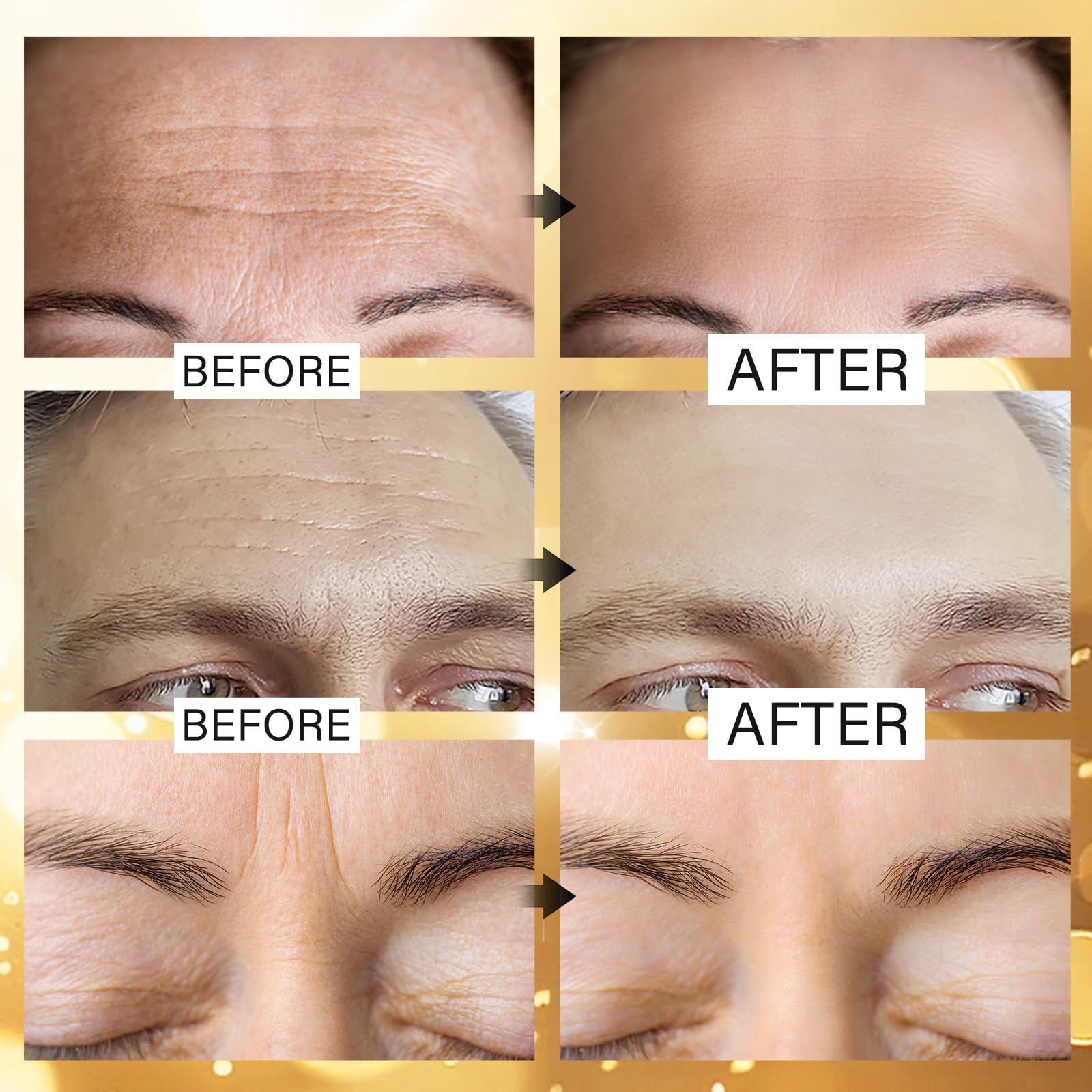 24K Gold Stirnfaltenpflaster für Gesicht, Hydrogel-Pads mit hydrolysiertem Kollagen und Vitamin E, Stirnfalten, Pflege für Streifen, feuchtigkeitsspendend, 20 Stück