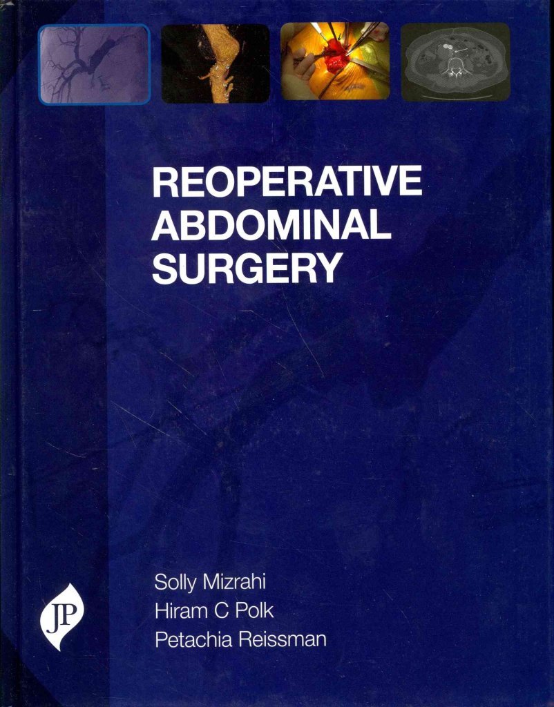 [(Reoperative Abdominal Surgery)] [By (author) Solly Mizrahi ] published on (August, 2014)