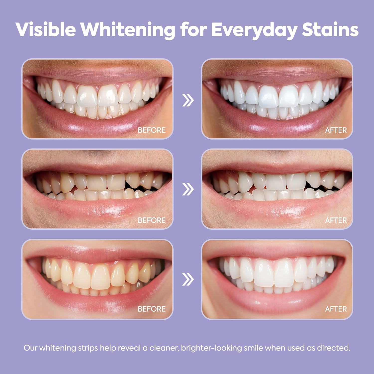 NIVELA Purple Teeth Whitening Strips : 14 Treatments Enamel Safe for Sensitive Tooth & Removes Yellow Stains & Bad Breath - Effective Color Correction for a Brighter Smile