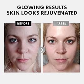 Eclat Skincare Face Serum Set - Vitamin C & Retinol Serum for Face - Anti Wrinkle, Dark Spots, Hydrating Facial Routine - 2 Pack Anti Aging Skin Care Set