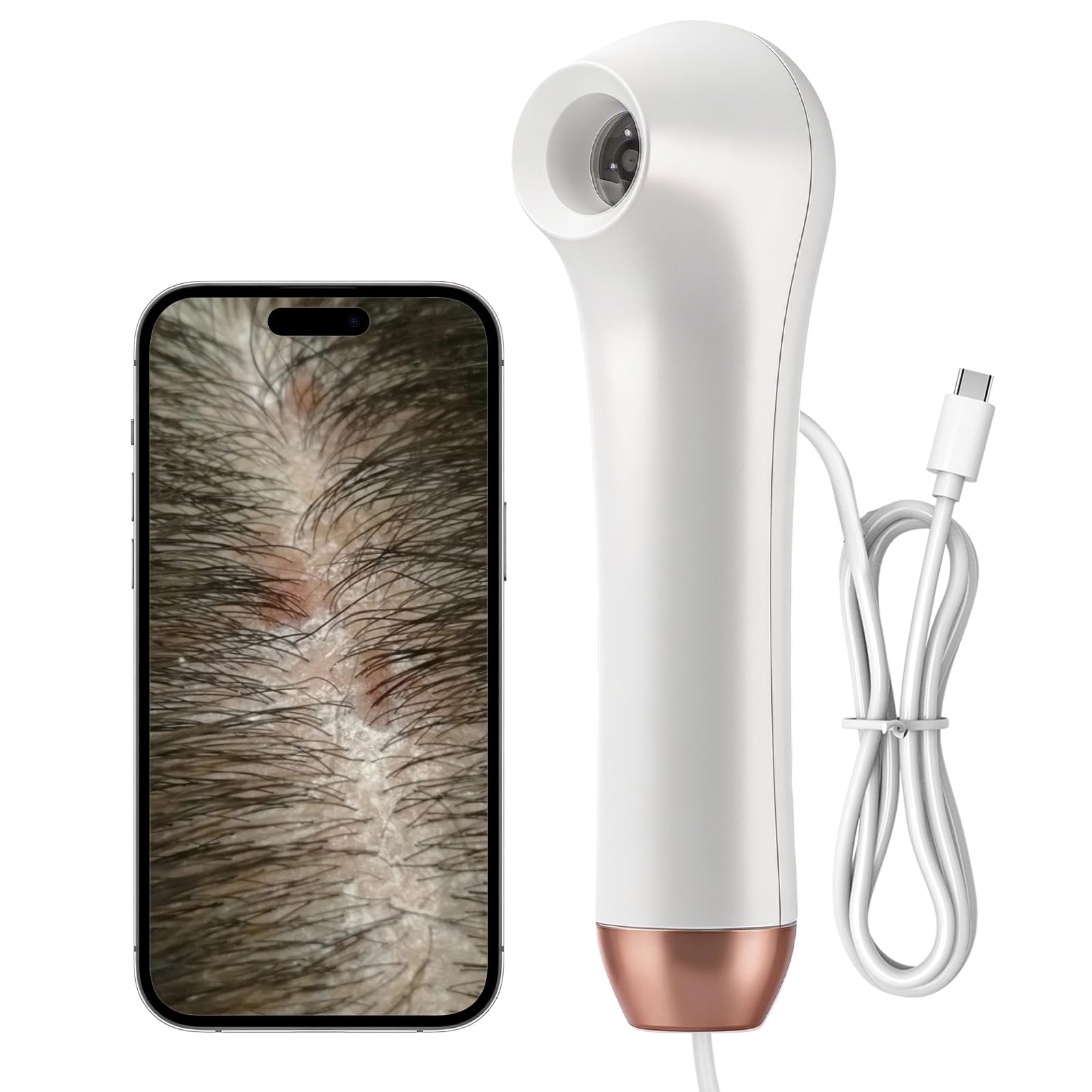 Machine d'analyse portable du cuir chevelu, 3 vitesses, 1 mégapixel, microscope du cuir chevelu, rechargeable pour follicule pileux, détecteur de grossissement d'humidité, test de pigment pour la tête