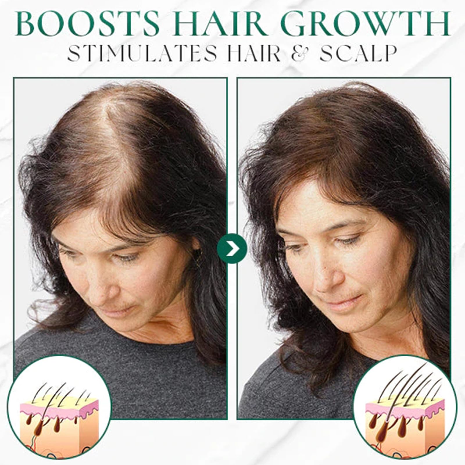 Scalp Scrub Scalp Exfoliating Scalp Scrub Hair Treatment Scalp Exfoliating for All Skin Types Head Massage and Dandruff Reduction - Image 4