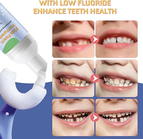 Miniatura 6 de Pasta de dientes de espuma para niños, 4 paquetes de pasta de dientes de espuma para cepillo de dientes eléctrico en forma de U, pasta de dientes