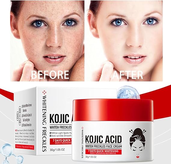 Face And Body hyperpigmentation cream, Dark Spot Remover for Face, Anti Freckles & Hyperpigmentation Corrector, Hydrating Face Creams for Dry Skin,Natural Ingredients Moisturizer(30g)