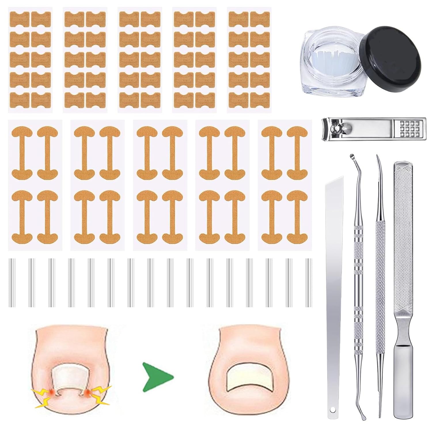Ingrown Toenail Corrector Tool Kit, Professional Foot Care Tool for Nail Groove Pain,Includes Breathable Toenail Strips, Curved Toenails Corrector Patch, Painless File and Lifter Pedicure Tools
