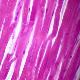 Human Cardiac Muscle Slide, 7 m, H&E