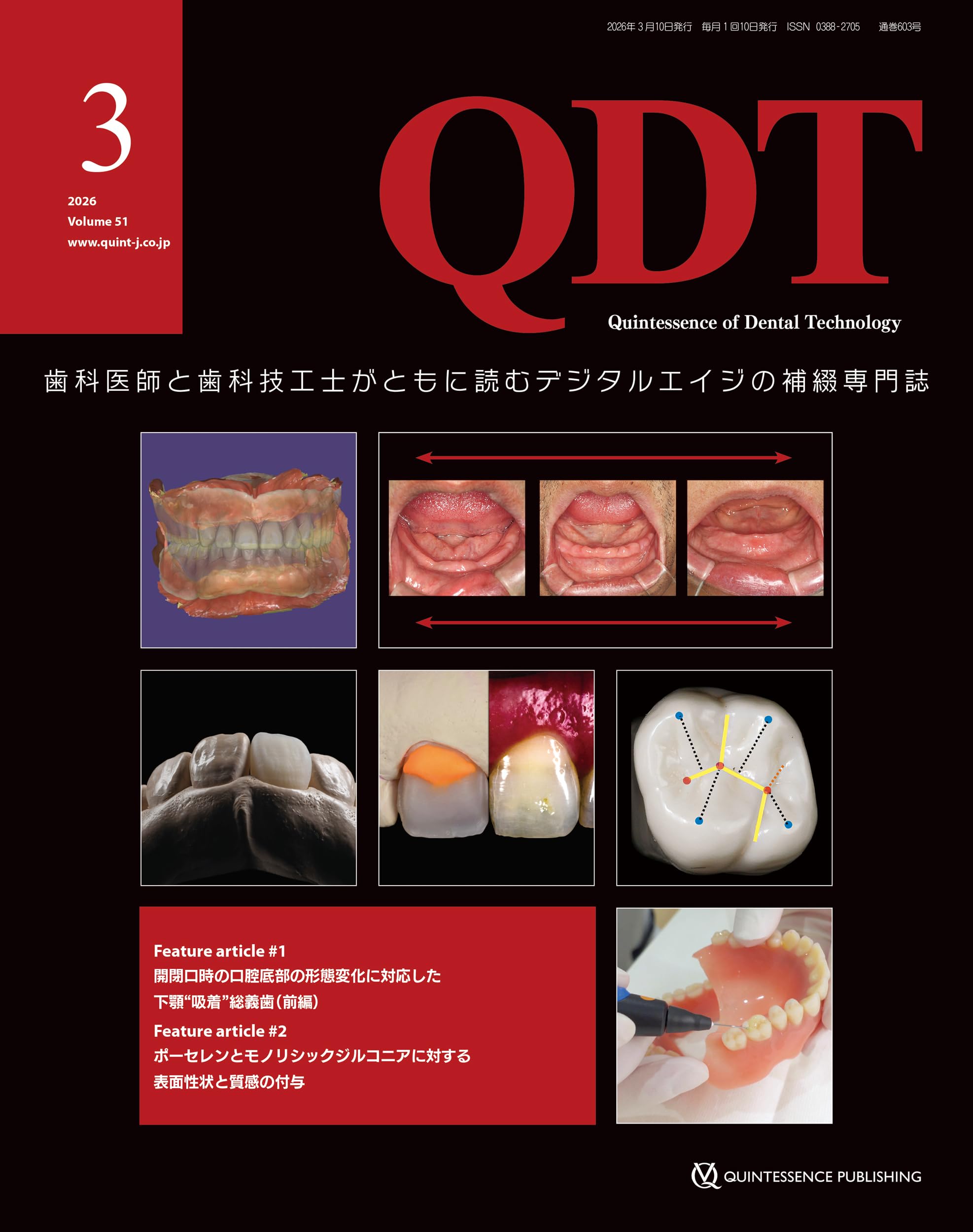 QDT 2026年3月号: 歯科医師と歯科技工士がともに読むデジタルエイジの