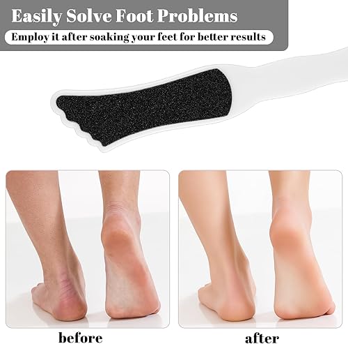 Miniatura 4 de Paquete de 10 limas de pies con herramientas de pedicura de doble cara para pies, lijadora profesional para piel muerta, escofina para mujeres,