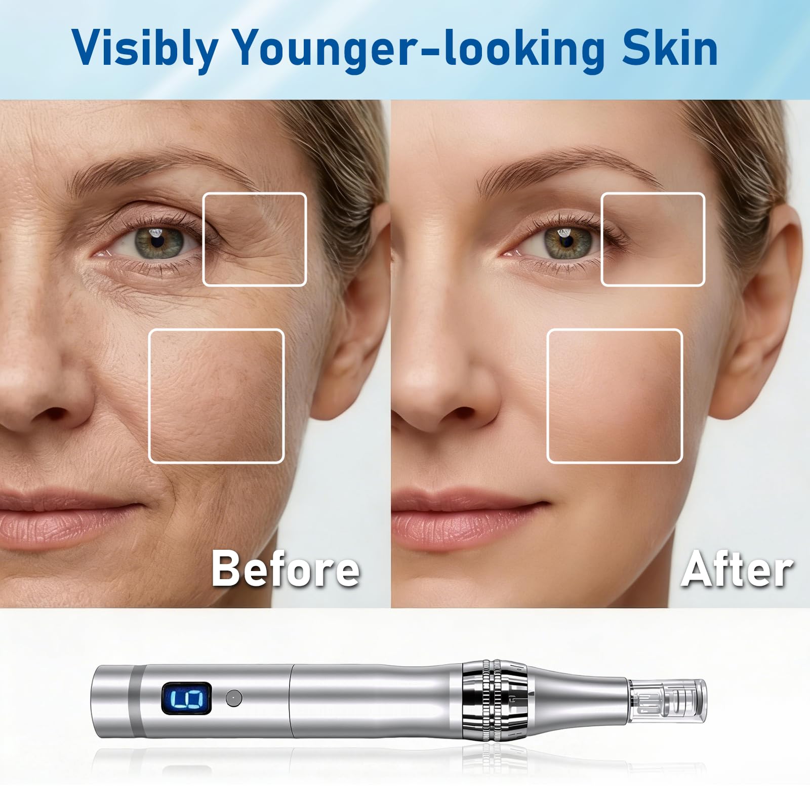 Microneedle Derma Roller Pen para mujeres y hombres, uso en casa, viajes, con 12 piezas de repuesto, kit de microagujas de 0.25 mm para piel
