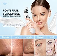 Vista 2 de Blackhead Remover Pore Vacuum, Upgraded Black Head Remover for Face, Electric Acne Comedone Whitehead Extractor Tools-5 Suction Power, 5 Probes, USB
