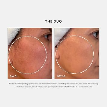U Beauty 3-Piece Set Resurfacing Compound 15mL + The SUPER Hydrator 15mL+ The PLASMA Lip Compound 15mL Anti-Aging Serum, Hydrating Cream & Contouring Lip Treatment with SIREN Capsule Technology