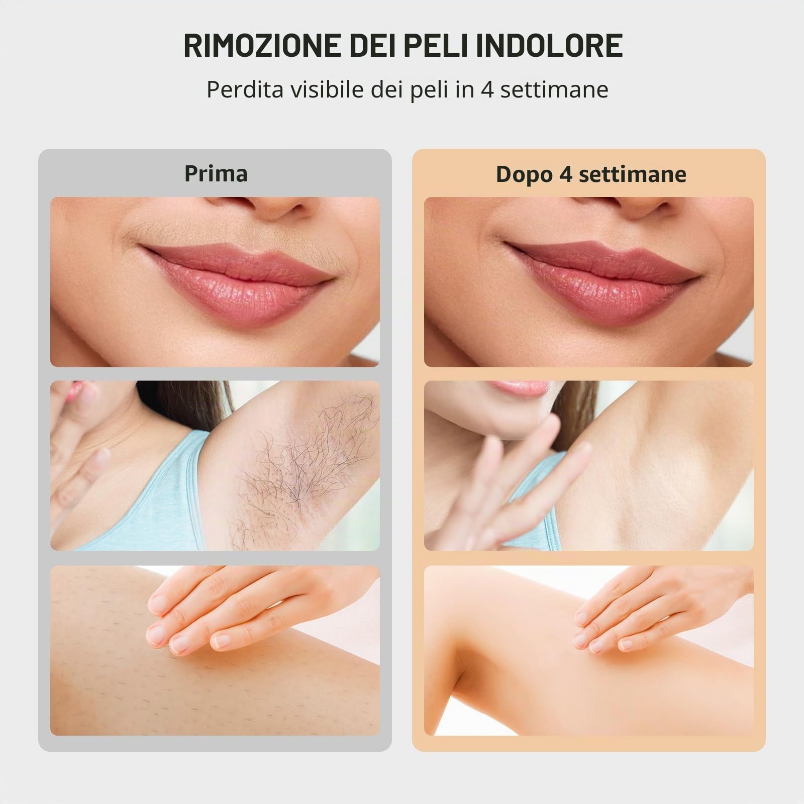 Dispositivo di depilazione IPL con tecnologia di raffreddamento del ghiaccio, dispositivo di depilazione laser aggiornamento 2026 con HR/SC/RA/BT, 10 livelli di energia, 999.999 flash per donne/uomini